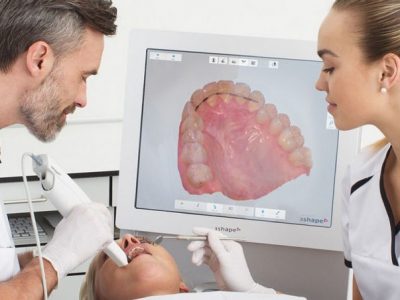 Escaneamento intraoral Escaneamento intraoral