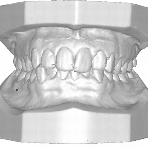 modelo 3D|Clínica Radiologica em Ipanema